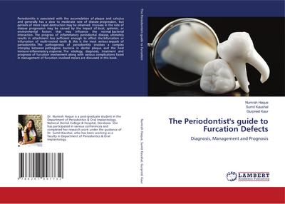 The Periodontist’s guide to Furcation Defects