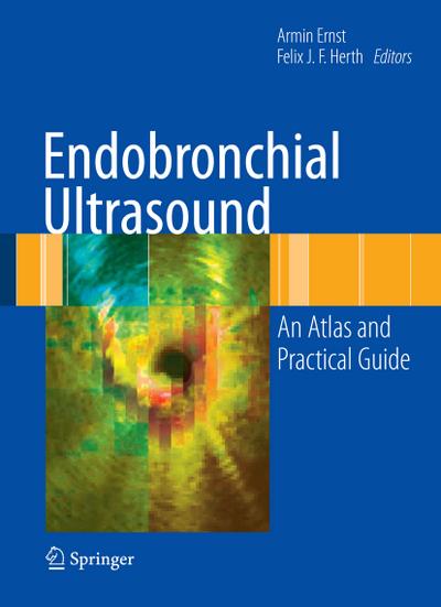 Endobronchial Ultrasound