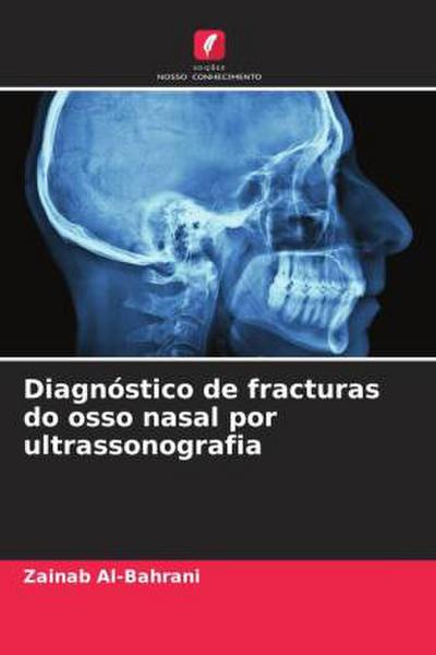 Diagnóstico de fracturas do osso nasal por ultrassonografia