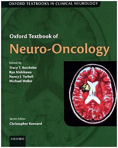Oxford Textbook of Neuro-Oncology