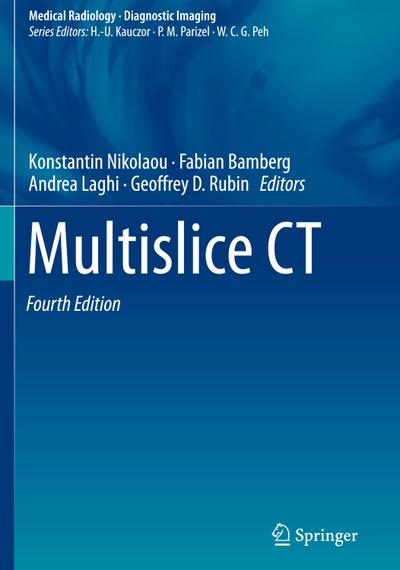 Multislice CT