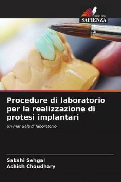 Procedure di laboratorio per la realizzazione di protesi implantari