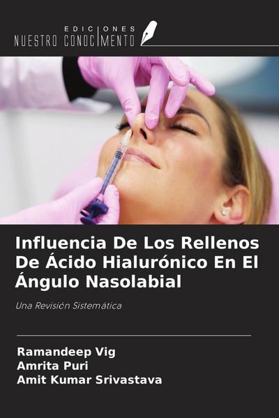 Influencia De Los Rellenos De Ácido Hialurónico En El Ángulo Nasolabial