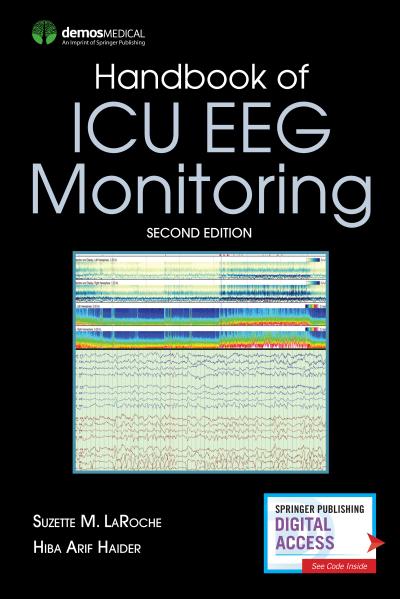 Handbook of ICU EEG Monitoring - second edition