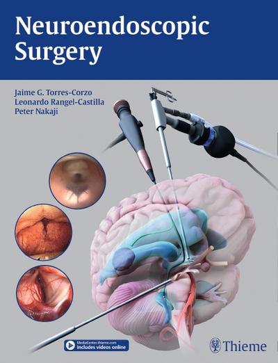 Neuroendoscopic Surgery