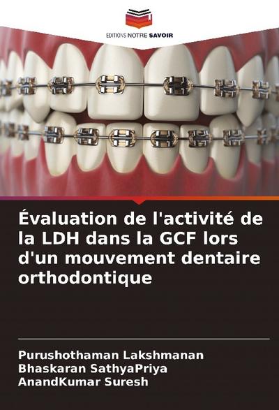 Évaluation de l’activité de la LDH dans la GCF lors d’un mouvement dentaire orthodontique