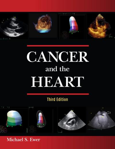 Cancer and the Heart