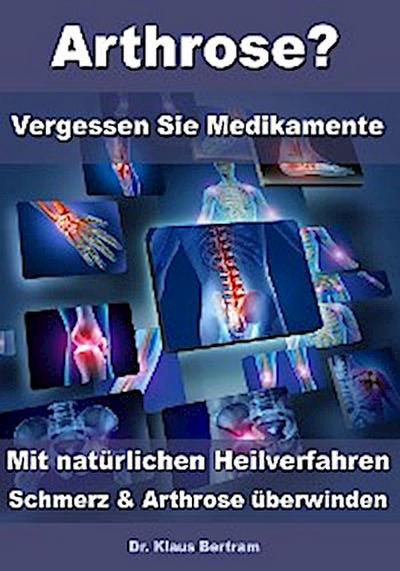 Arthrose? – Vergessen Sie Medikamente – Mit natürlichen Heilverfahren Schmerz & Arthrose überwinden