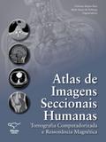 Atlas de Imagens Seccionais Humanas: Tomografia Computadorizada e Ressonância Magnética