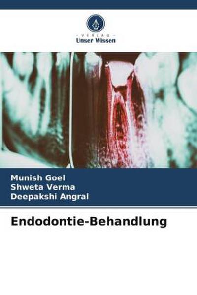 Endodontie-Behandlung