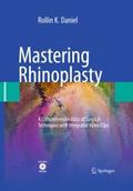 Mastering Rhinoplasty