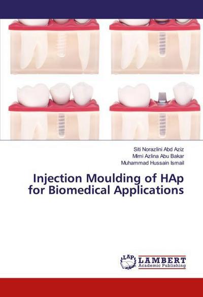 Injection Moulding of HAp for Biomedical Applications