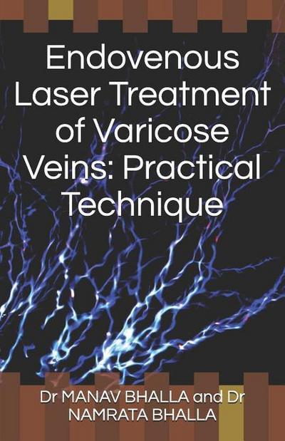 Endovenous Laser Treatment of Varicose Veins: Practical Technique