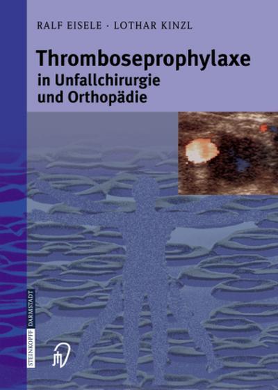 Thromboseprophylaxe in Unfallchirurgie und Orthopädie