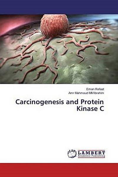 Carcinogenesis and Protein Kinase C