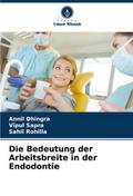 Die Bedeutung der Arbeitsbreite in der Endodontie