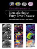 Clinical Dilemmas in Non-Alcoholic Fatty Liver Dis