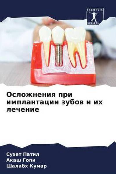 Oslozhneniq pri implantacii zubow i ih lechenie