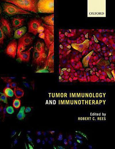 Tumor Immunology and Immunotherapy