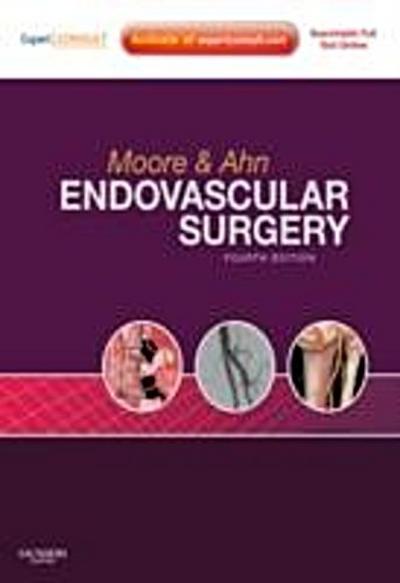 Endovascular Surgery E-Book