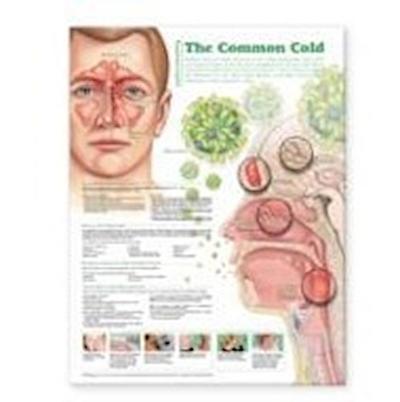 UNDERSTANDING THE COMMON COLD