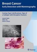 Breast Cancer Casting Type Calcifications: Sign of a Subtype with Deceptive Features