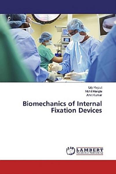 Biomechanics of Internal Fixation Devices
