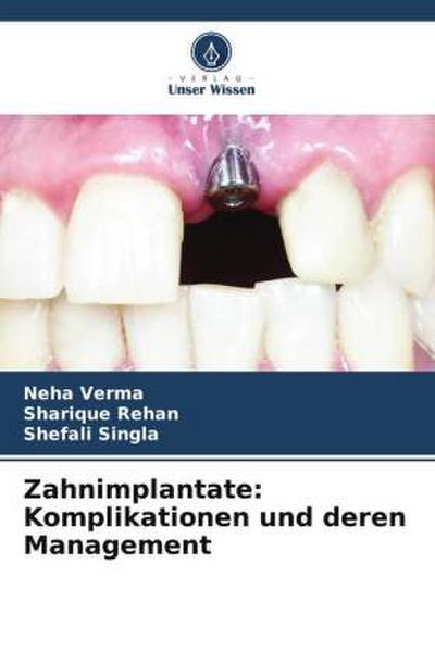 Zahnimplantate: Komplikationen und deren Management