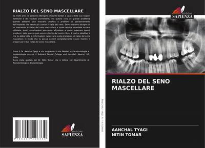 RIALZO DEL SENO MASCELLARE