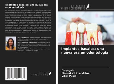 Implantes basales: una nueva era en odontología