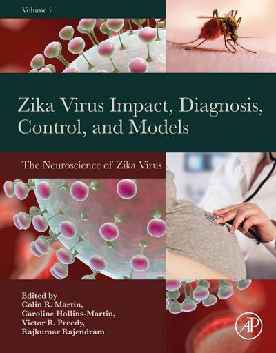 Zika Virus Impact, Diagnosis, Control, and Models