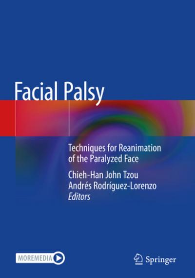 Facial Palsy