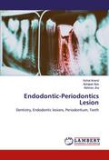 Endodontic-Periodontics Lesion