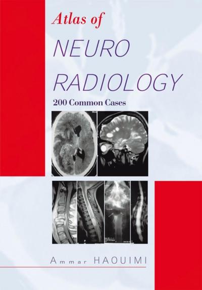 Atlas of Neuroradiology
