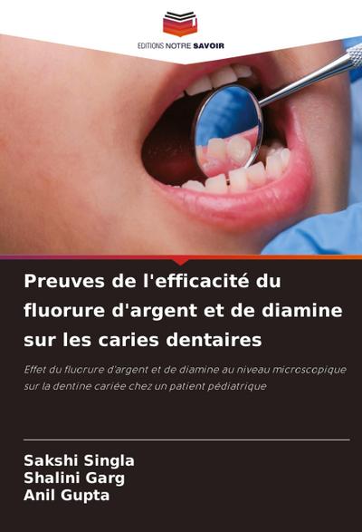 Preuves de l’efficacité du fluorure d’argent et de diamine sur les caries dentaires