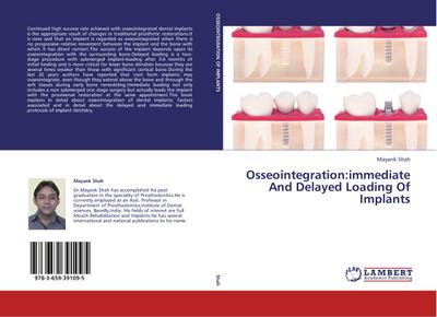 Osseointegration:immediate And Delayed Loading Of Implants - Mayank Shah