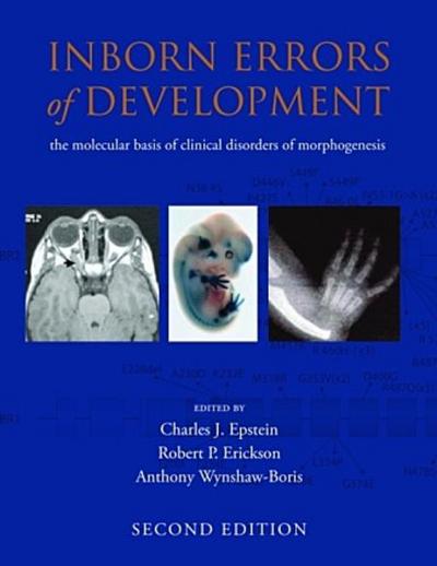 Inborn Errors of Development