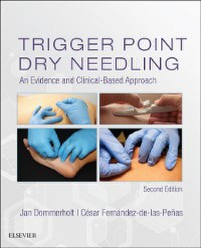 Trigger Point Dry Needling E-Book