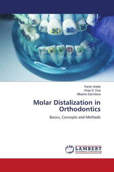 Molar Distalization in Orthodontics