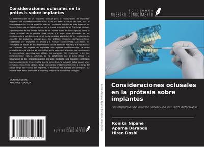 Consideraciones oclusales en la prótesis sobre implantes