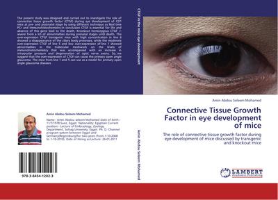 Connective Tissue Growth Factor in  eye development of mice