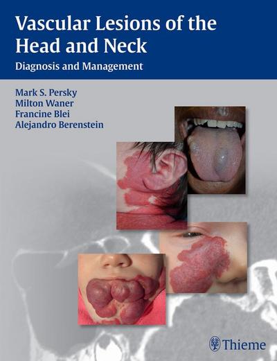 Vascular Lesions of the Head and Neck