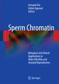 Sperm Chromatin