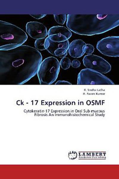 Ck - 17 Expression in OSMF