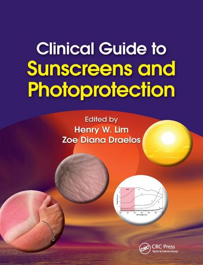 Clinical Guide to Sunscreens and Photoprotection