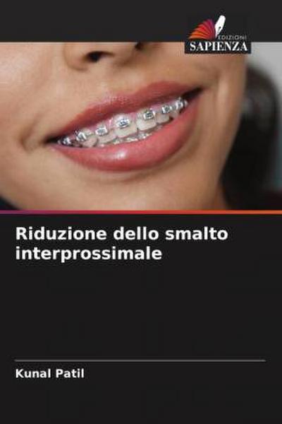 Riduzione dello smalto interprossimale