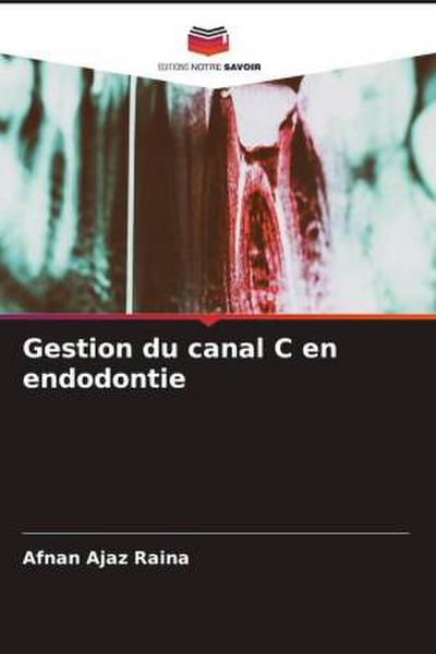 Gestion du canal C en endodontie