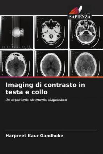 Imaging di contrasto in testa e collo