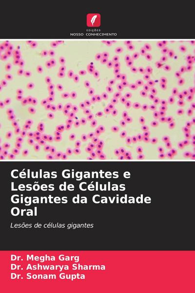 Células Gigantes e Lesões de Células Gigantes da Cavidade Oral