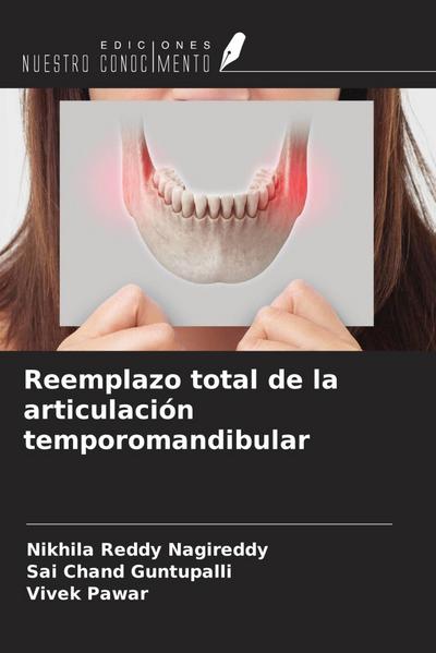 Reemplazo total de la articulación temporomandibular